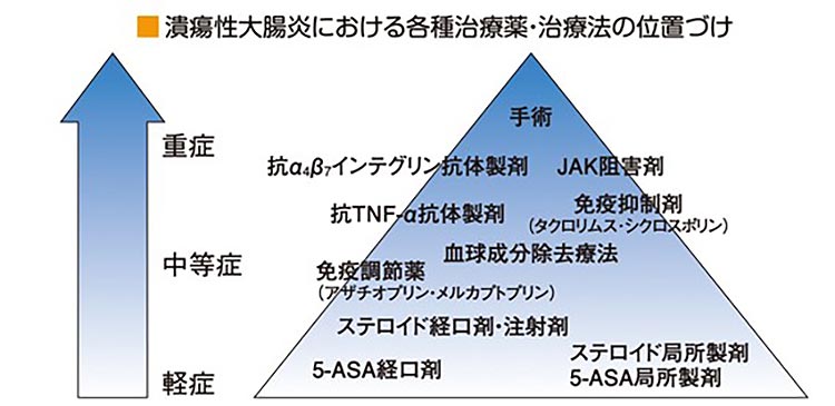 潰瘍性大腸炎における各種治療薬・治療法の位置づけ