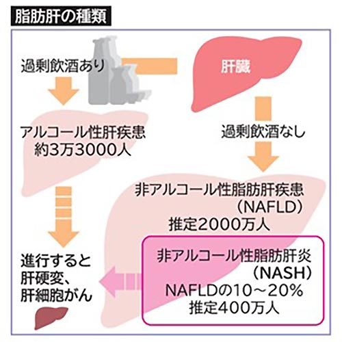 非アルコール性脂肪肝イメージ